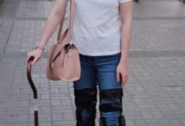 Лікарська помилка чи витівка організму: «Тепер кожен крок — наче підкорила Еверест»