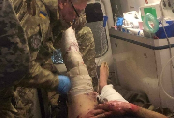 «Роблю все від мене залежне, щоб поранені вижили»