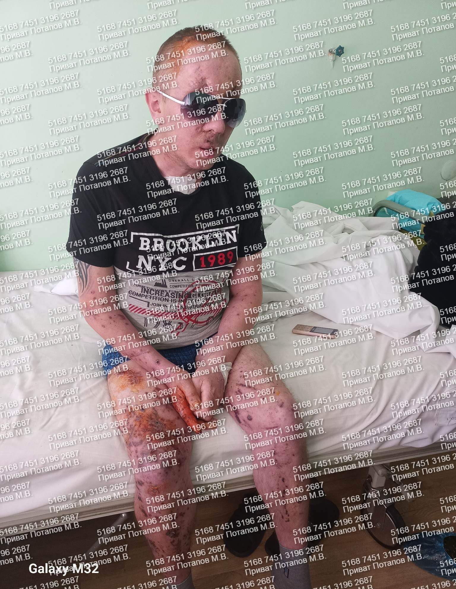 Дивом залишився живим