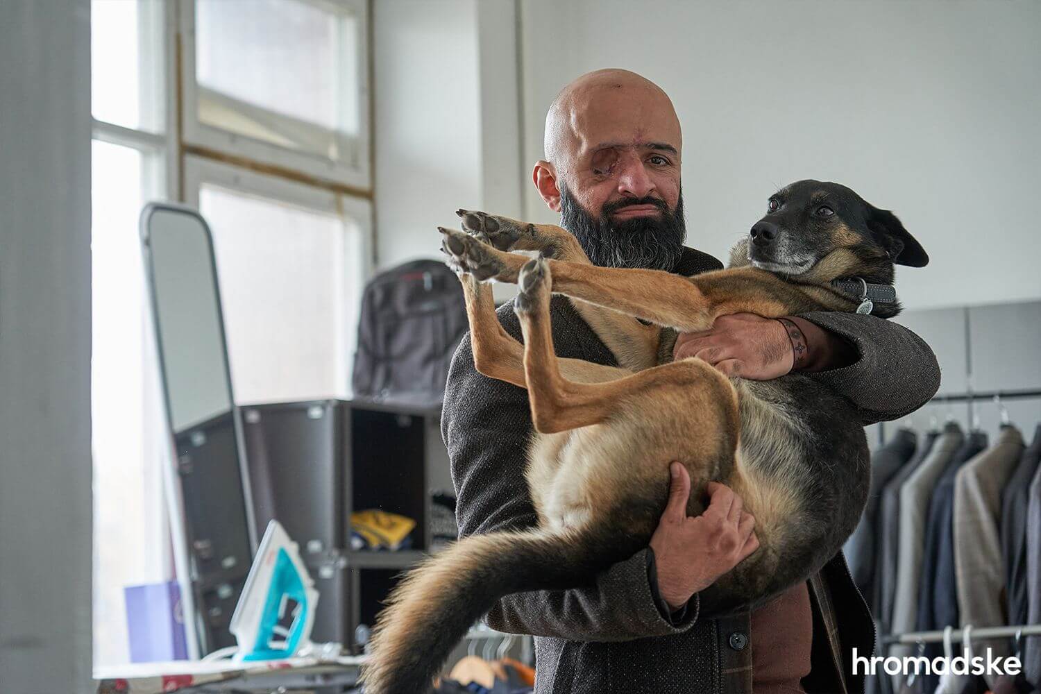 Історія реабілітації: «Втрата ока, руки чи ноги —  це маленька смерть»