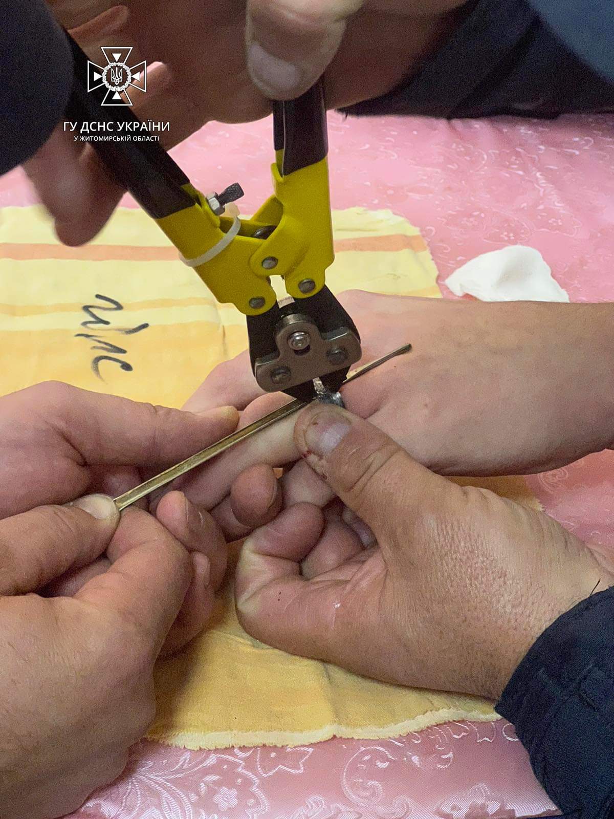 Приміряв чужу каблучку — знімали рятувальники